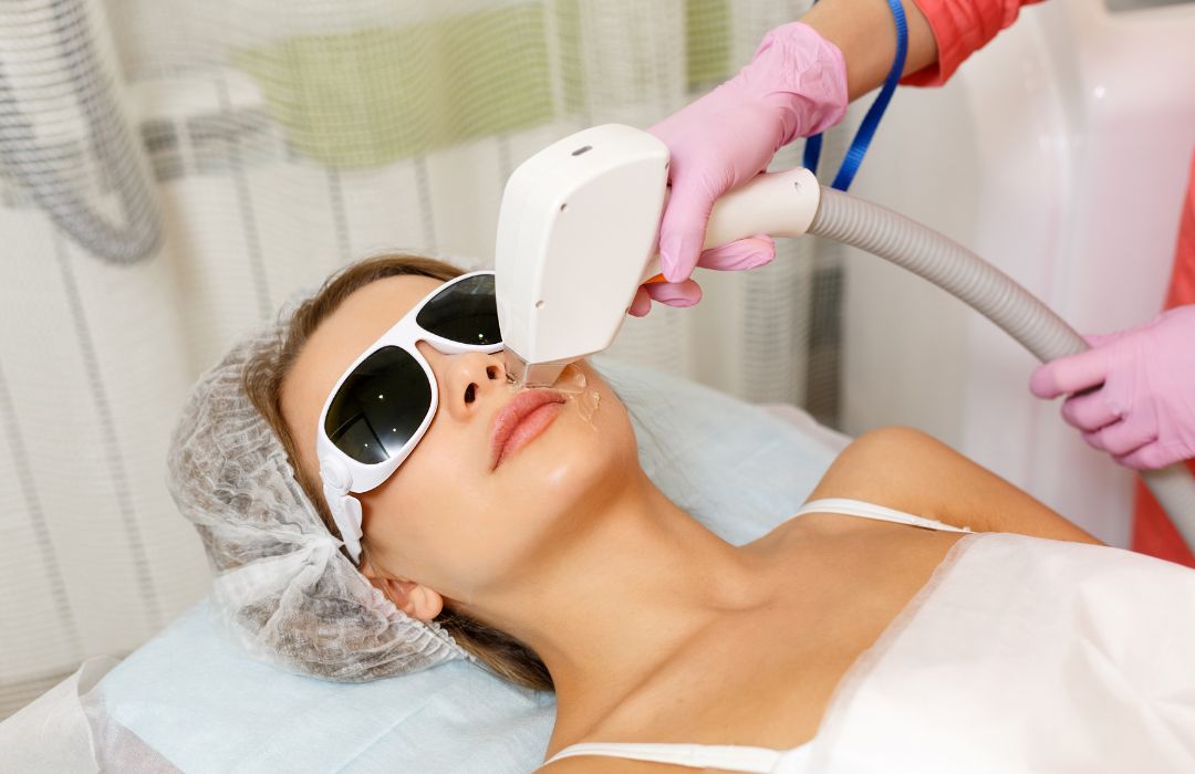laser hair removal
